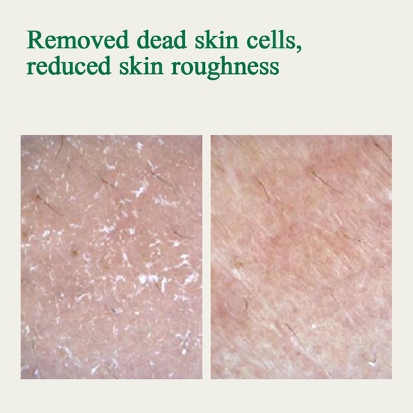 Pyunkang Yul Ultimate Calming Solution Toner (Pack of 2) 3.71fl oz - Picture 5 of 9